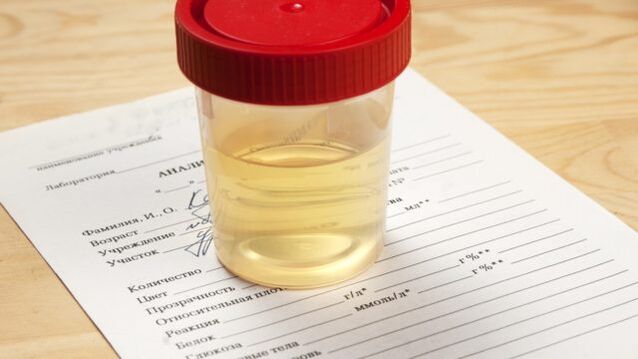 Urine analysis of arterial hypertension